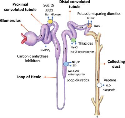 New Insights Into Diuretic Use to Treat Congestion in the ICU: Beyond Furosemide